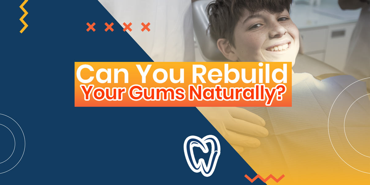 Can You Rebuild Your Gums Naturally?
